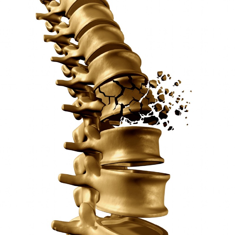 Grafik Wirbelsäule